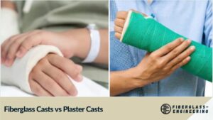 Fiberglass Casts vs Plaster Casts